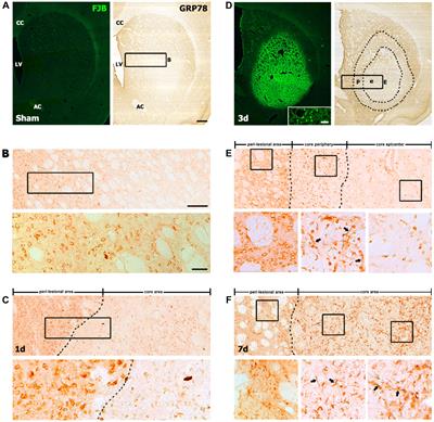 Spatiotemporal Expression of GRP78 in the Blood Vessels of Rats Treated With 3-Nitropropionic Acid Correlates With Blood–Brain Barrier Disruption